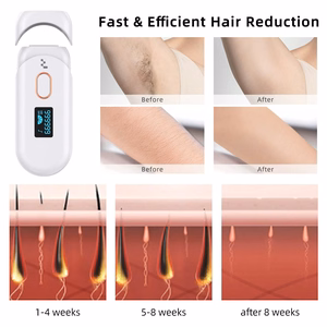 Fotoepilaator Reach IPL-1 valge